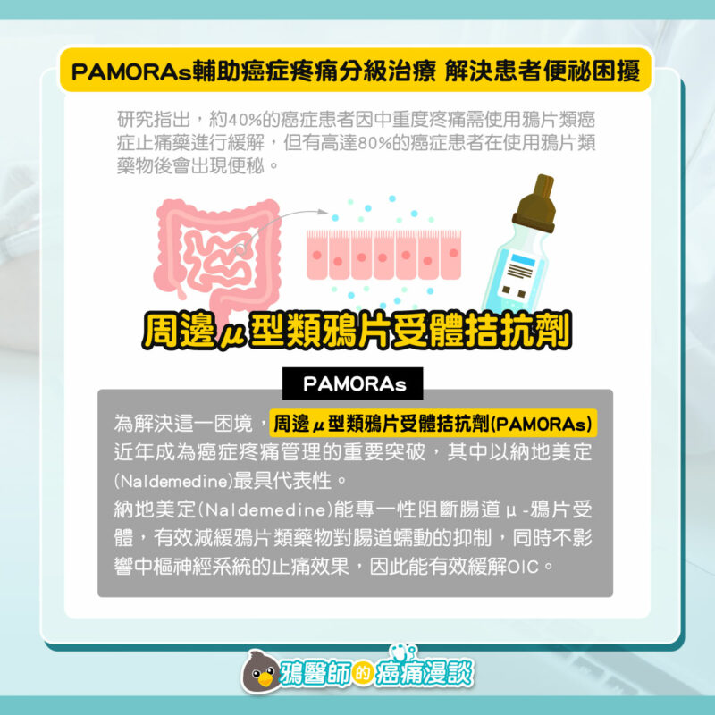癌症疼痛分級怎麼分?3種疼痛等級對應升降階用藥策略全解析 癌症疼痛 便祕